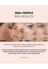 NUDESTIX NUDESKIN 3-STEP CITRUS SKIN RENEWAL - MAKEUP (MELT, MICRO-PEEL, MOISTURIZER) - Ansiktsvårdsset