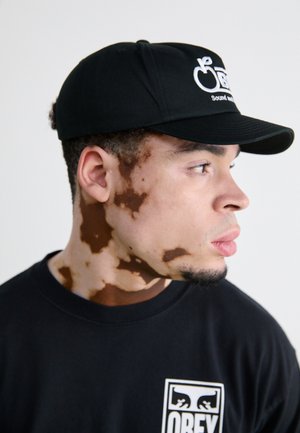 Gorra negra con logo bordado, camiseta negra con diseño gráfico. Presenta piel de color marrón claro con un patrón de pigmentación irregular.