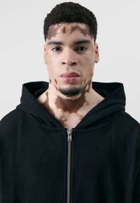 Schwarze Zip-Hoodie mit geripptem Textur, mit einem Frontreißverschluss und einer Kapuze. Modell hat auffällige Hautmuster im Gesicht und am Hals.