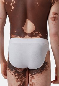 Slip bianchi in cotone con una fascia morbida, indossati da una persona con una carnagione scura che mostra vari schemi di pigmentazione più chiara.