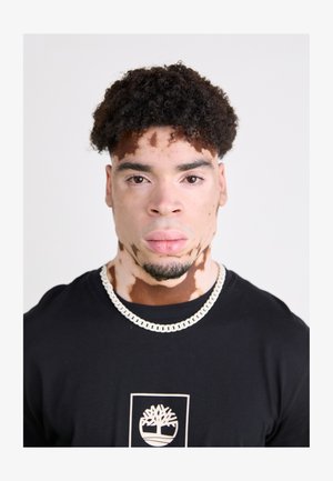 Musta T-paita, jossa on graafinen logo, hopeaketju kaulassa, lyhyet kiharat hiukset ja monivärinen ihonsävy, jossa on vaaleita ja tummia laikkuja.