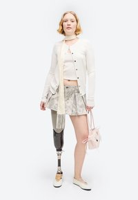 Νέα γυναίκα με κοντά ξανθά μαλλιά, φοράει λευκή ζακέτα, φούστα με σχέδια, ανοιχτόχρωμο φουλάρι, κρατάει ροζ τσάντα και χρησιμοποιεί προσθετικό δεξί πόδι.