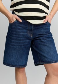 Pantalones cortos de mezclilla con un lavado azul oscuro, corte relajado, bolsillos laterales y costuras visibles. El dobladillo cae justo por encima de las rodillas.
