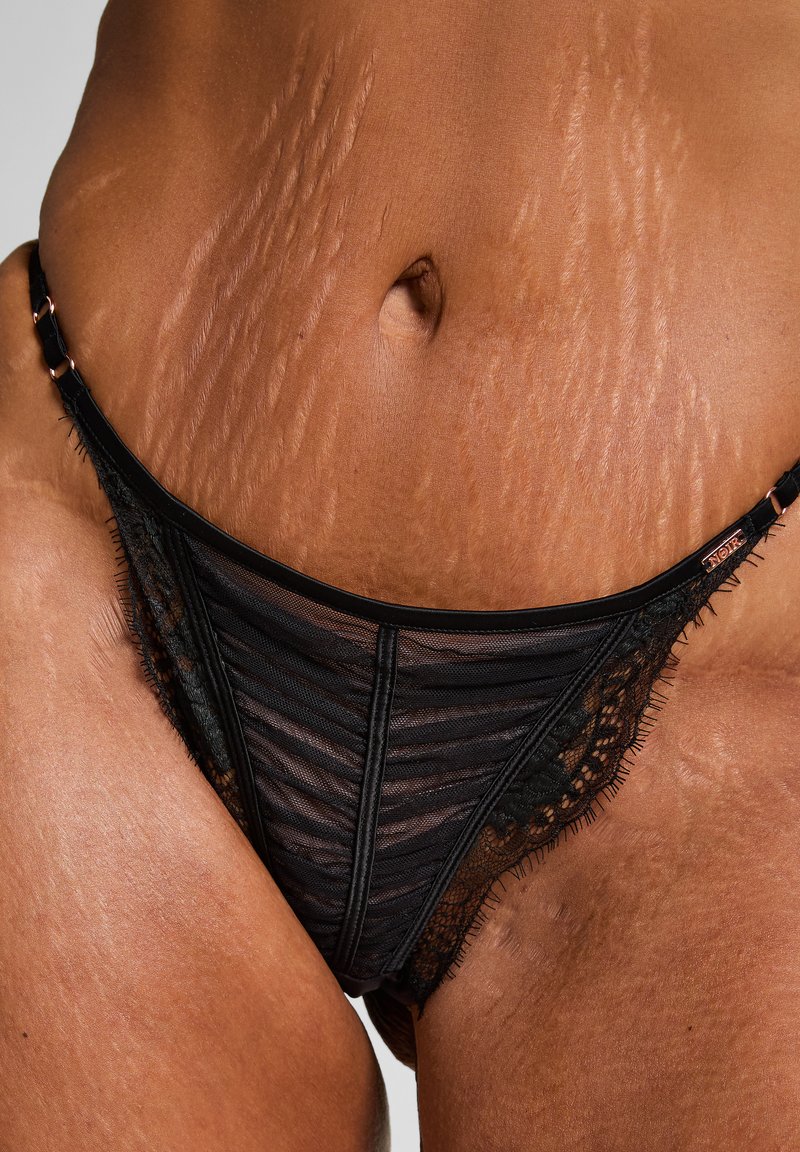 Gros plan sur le milieu du corps d'une personne portant des sous-vêtements en dentelle noire, montrant des vergetures visibles sur sa peau.