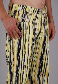 Man wearing yellow, black, and white patterned jeans with hand resting on pocket, showing bracelet on right wrist and bare midriff.