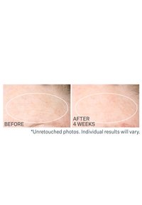 StriVectin SD ADVANCED™ PLUS INTENSIVE MOISTURIZING CONCENTRATE - Feuchtigkeitspflege