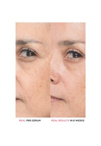 Comparaison en gros plan du visage d'une femme montrant une réduction des rides et une amélioration de la texture de la peau après 6 semaines d'utilisation du sérum.