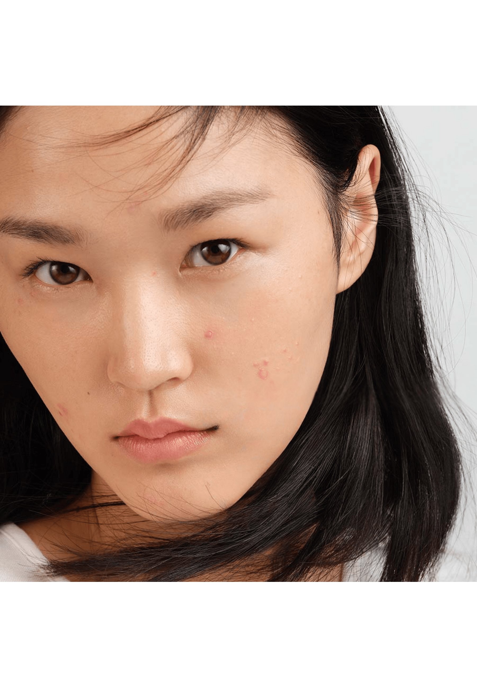 Bioderma SÉBIUM HYDRA - REBALANCING MOISTURIZER FOR ACNE-PRONE