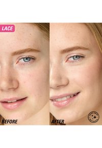 Delad bild som visar huden före och efter behandling. Vänster: ojämn textur, rodnad synlig. Höger: jämn hud, klar hy, vita tänder.