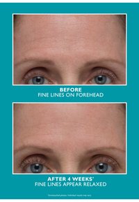 Miniatuurafbeelding 5