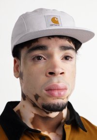 White canvas cap with a yellow Carhartt logo, worn above a brown shirt. Clear skin tone with light and dark patches, short curly hair.