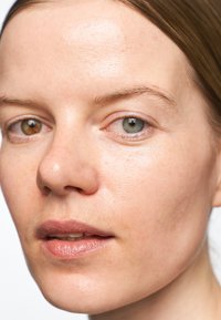 Närbild av ett ansikte med jämn hudton, lätta fräknar och två olika färger på ögonen: bruna och blå. Läpparna är något åtskilda, vilket visar en naturlig glans.