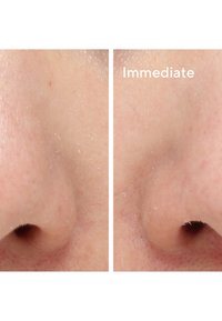 Murad TARGETED PORE CORRECTOR - Dagkräm