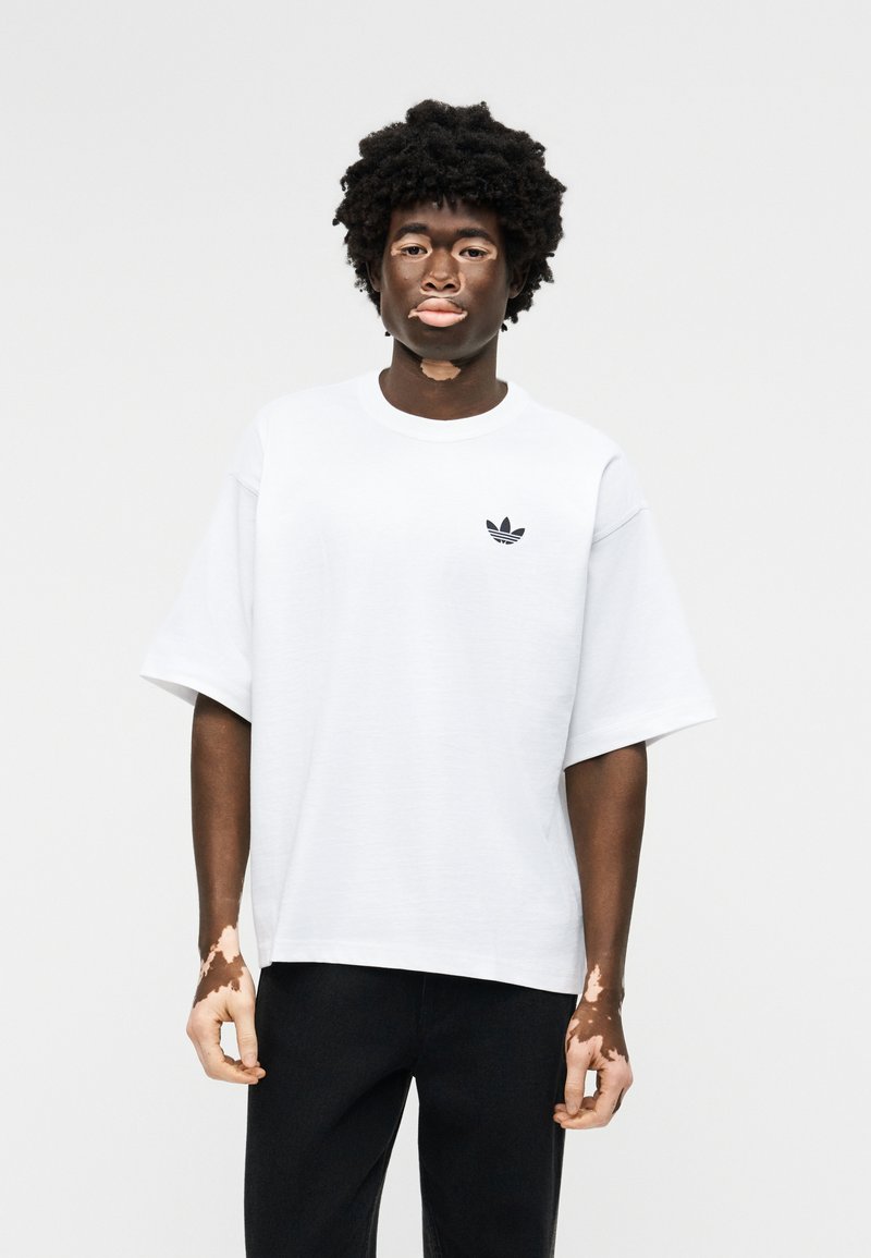 Junge Person mit Vitiligo, die ein weißes Adidas-T-Shirt und schwarze Hose trägt und vor einem schlichten hellen Hintergrund steht.