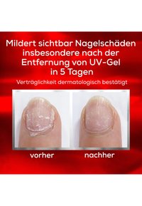Nagelschaden vor und nach der Behandlung, zeigt eine unebene, trockene Textur mit klar verbesserter Erscheinung und reduzierter Verfärbung im rechten Bild.