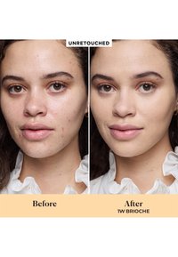 Ritratti affiancati di una donna che mostra una pelle più chiara e liscia con riduzione di acne e arrossamenti dopo l'uso di 1W Brioche rispetto a una pelle non trattata.
