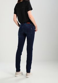 Jeans attillati blu scuro con vita alta, dotati di tasche posteriori, leggera usura e abbinati a sneaker bianche. La texture è liscia.