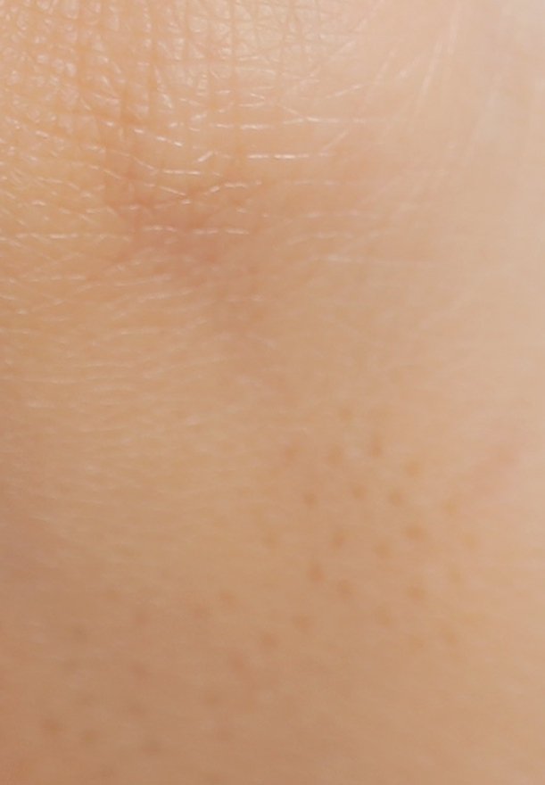 Gros plan montrant une texture de peau lisse et claire avec de fines lignes et de petites taches de rousseur ou pores légers.