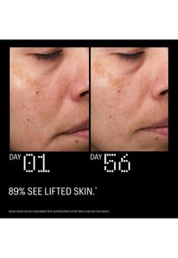 Comparaisons en gros plan de la joue d'une femme au jour 1 et au jour 56 montrant une peau plus lisse, liftée avec des rides et des fines lignes réduites.