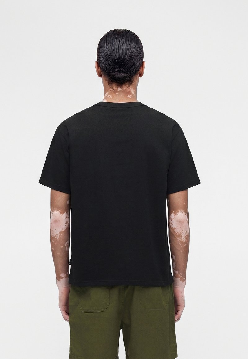 Person mit Vitiligo-Flecken am Hals und an den Armen, die ein schwarzes T-Shirt und grüne Shorts trägt, steht mit dem Rücken zum Betrachter.