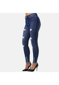 Jeans de mezclilla azul ajustados con detalles desgastados y dobladillo deshilachado, que presentan adornos en el tobillo y un diseño de cintura alta.