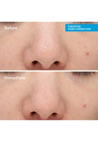 Murad TARGETED PORE CORRECTOR - Dagkräm