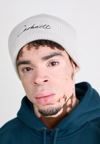 Grau gestrickte Mütze mit schwarzem gesticktem Logo, getragen mit einem blauen Hoodie. Die Haut weist Bereiche mit unterschiedlicher Farbe und Textur auf. Nahaufnahme.