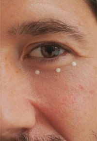 Under-eye area with three small, creamy dots of product on skin. Skin shown is light-toned with slight texture and visible pores.