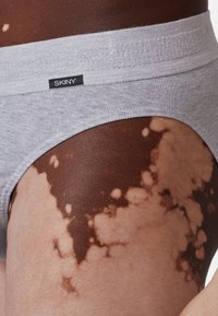 Primo piano dell'anca di una persona con vitiligine che indossa biancheria intima grigia chiaro con l'etichetta "SKINY."