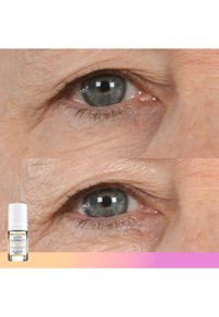 Produit de soin de la peau présenté à côté d'images avant-après du même œil, montrant une réduction des cernes et des rides fines. Le produit est une petite bouteille avec un bouchon blanc.