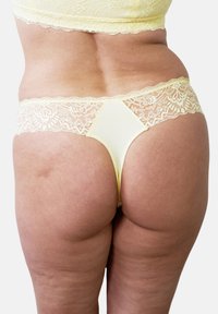 Yellow lace-trimmed thong with a smooth fabric, featuring a triangular back design, and delicate floral lace along the waistband and edges.