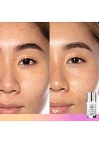 Peau avant (gauche) et après (droite) le traitement avec un sérum. Amélioration visible de la texture, réduction des rougeurs et éclat poli. Produit dans le coin inférieur.