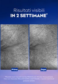 Immagini prima e dopo che mostrano la texture della pelle; a sinistra ci sono rughe più profonde, mentre a destra la pelle appare più liscia. Formato in bianco e nero.