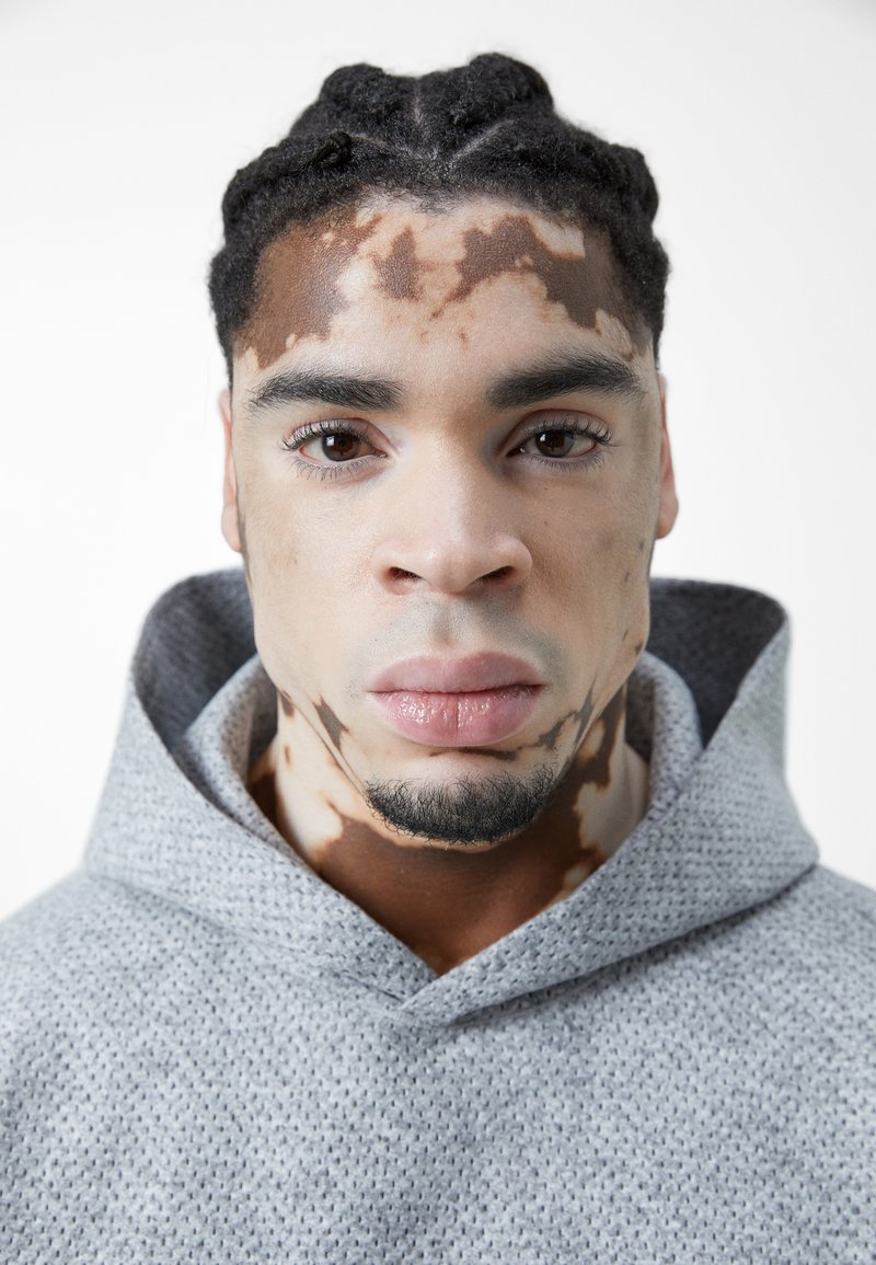 Szary, teksturowany hoodie z dużym kapturem. Zbliżenie na twarz osoby, ukazujące wyraźne różnice w tonie skóry.