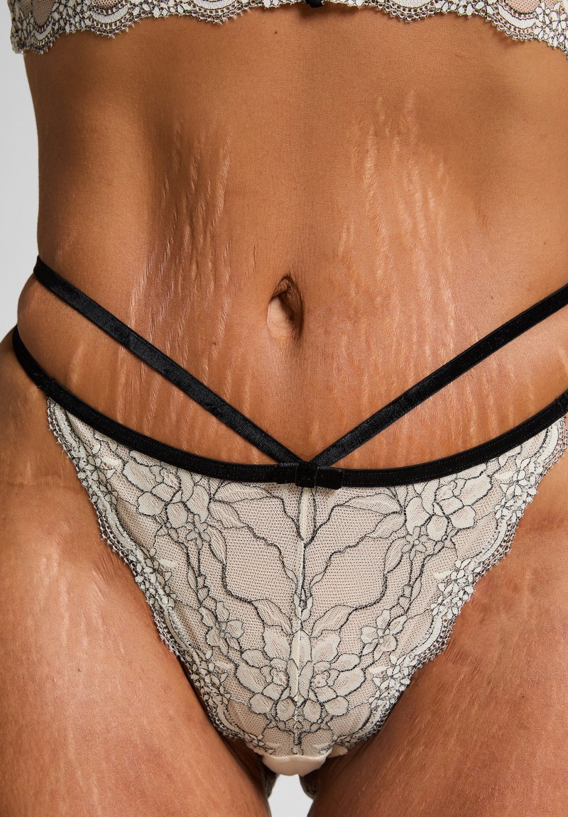 Close-up van de taille in kanten ondergoed met zwarte banden, met zichtbare natuurlijke huidschade in de vorm van strepen op de buik en heupen.