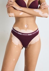 Žena s vitiligo kožom nosi bordo Puma donje rublje i grudnjak, prekriženih ruku preko grudi na jednostavnoj pozadini.