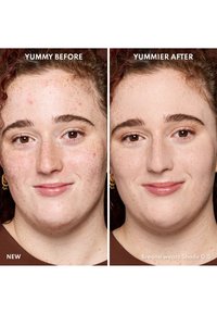 Comparaison avant-après d'un visage montrant un teint de peau avec des taches de rousseur et des imperfections ; le côté gauche présente des imperfections, tandis que le côté droit semble plus lisse.