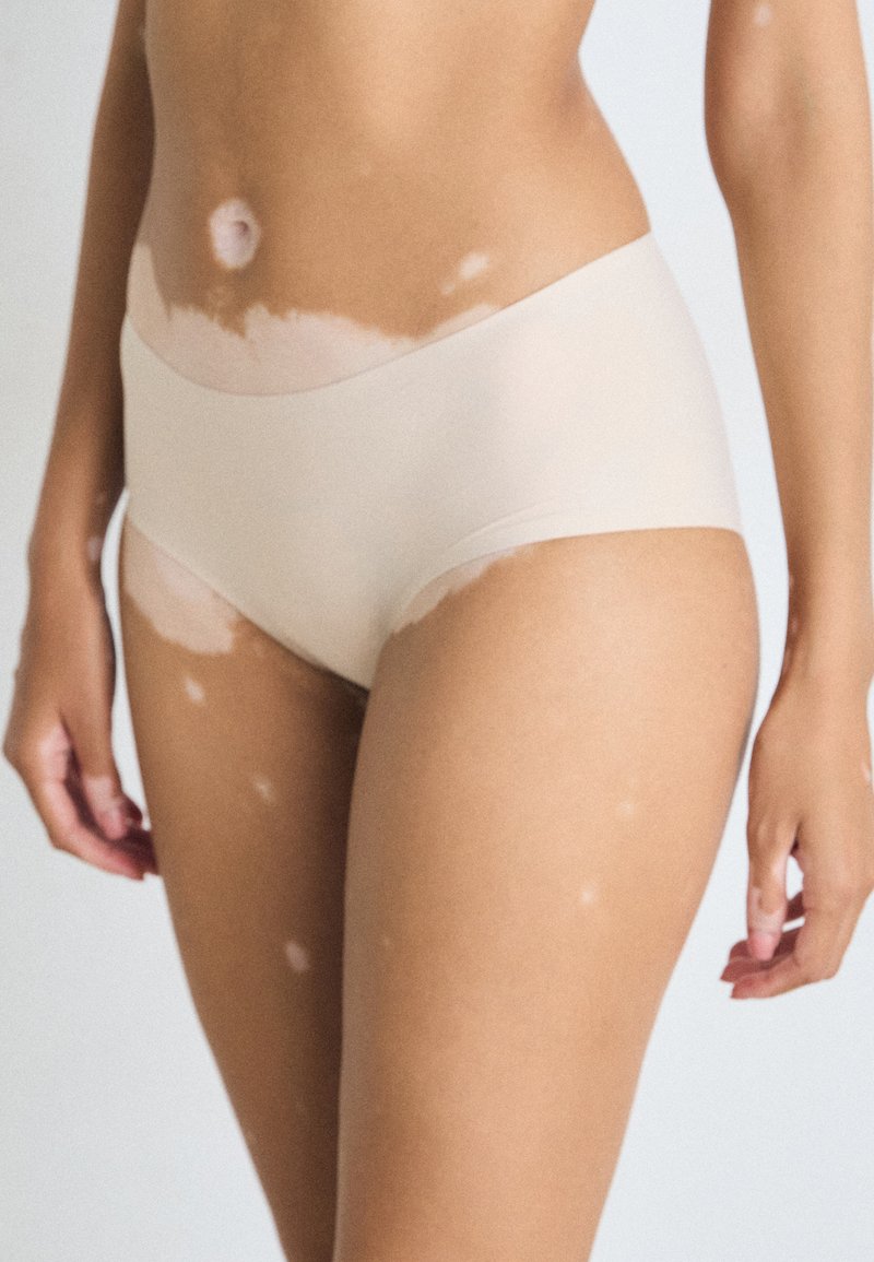 Közelkép egy személy alsó törzséről és felső lábáról, amely a vitiligo bőrbetegséget mutat, zökkenőmentes bézs alsóneműt viselve.