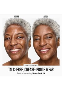 Foto de antes y después que muestra a una persona con cabello gris corto y texturizado y piel clara. Las etiquetas indican los resultados de "antes" y "después".