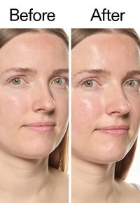 Neben-zu-Neben-Vergleich der Gesichtshaut vor und nach der Behandlung. Beide Bilder zeigen glatte Haut mit einem sichtbaren Anstieg an Glanz und Hydratation.