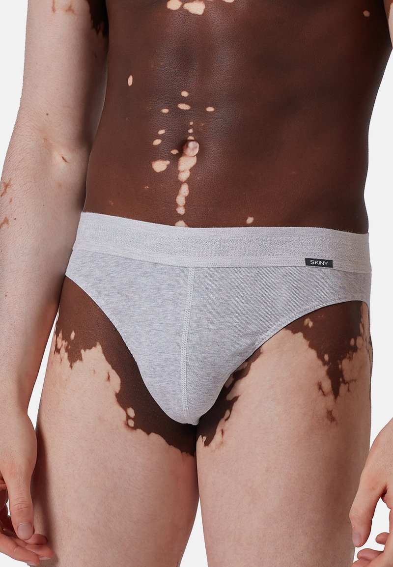Torso maschile con vitiligine che indossa slip grigi chiari con etichetta "Skiny" sul cinturino su uno sfondo bianco.