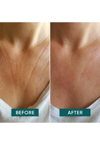 Apricot Beauty DÉKOLLETÉ PAD WITH HYALURON - Accessori skincare