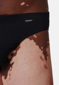 Slip di cotone nero con una fascia larga che presenta un'etichetta "SKINY". Mostra la pelle con un leggero motivo di pigmentazione, primo piano sulla gamba.