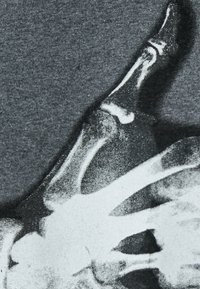 Tela gris con un gráfico anatómico de una mano en blanco y negro, destacando los huesos en detalle con una textura suave y un claro contraste.