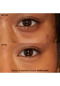 Deux images en gros plan de la zone des yeux, étiquetées "Avant" et "Après". L'image "Après" montre une peau plus lisse avec une réduction de la décoloration et des imperfections.