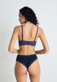 Vrouw met vitiligo in donkerblauwe kanten lingerie, staand met de rug naar de camera tegen een effen lichte achtergrond.