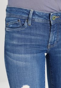 Vaqueros de mezclilla azul con un diseño clásico de cinco bolsillos, un ligero desgaste y un detalle desgastado en el muslo derecho.