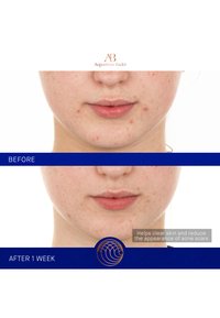 Augustinus Bader THE RETINOL SERUM - Siero