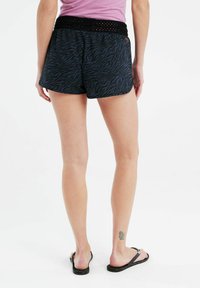 Zwarte shorts met een blauw zebra patroon, voorzien van een gestructureerde zwarte haakjes elastische tailleband. Model draagt slippers en toont tattoo op de enkel.