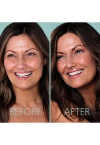 Two side-by-side portraits of a woman, left labeled "BEFORE" showing less radiance, right labeled "AFTER" with smoother skin and enhanced glow.